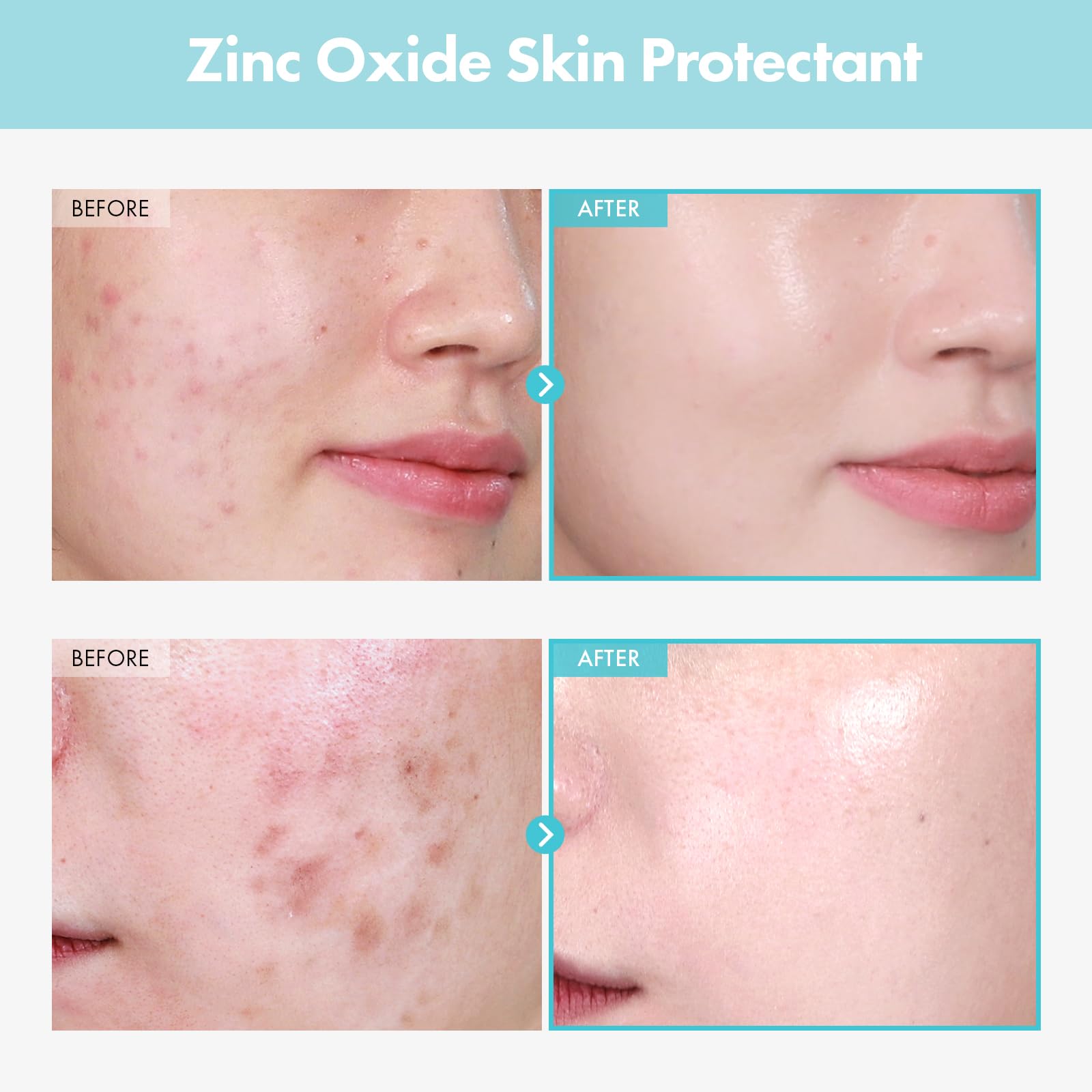 TOSOWOONG zinc oxide powder close-up emphasizing skin protection.