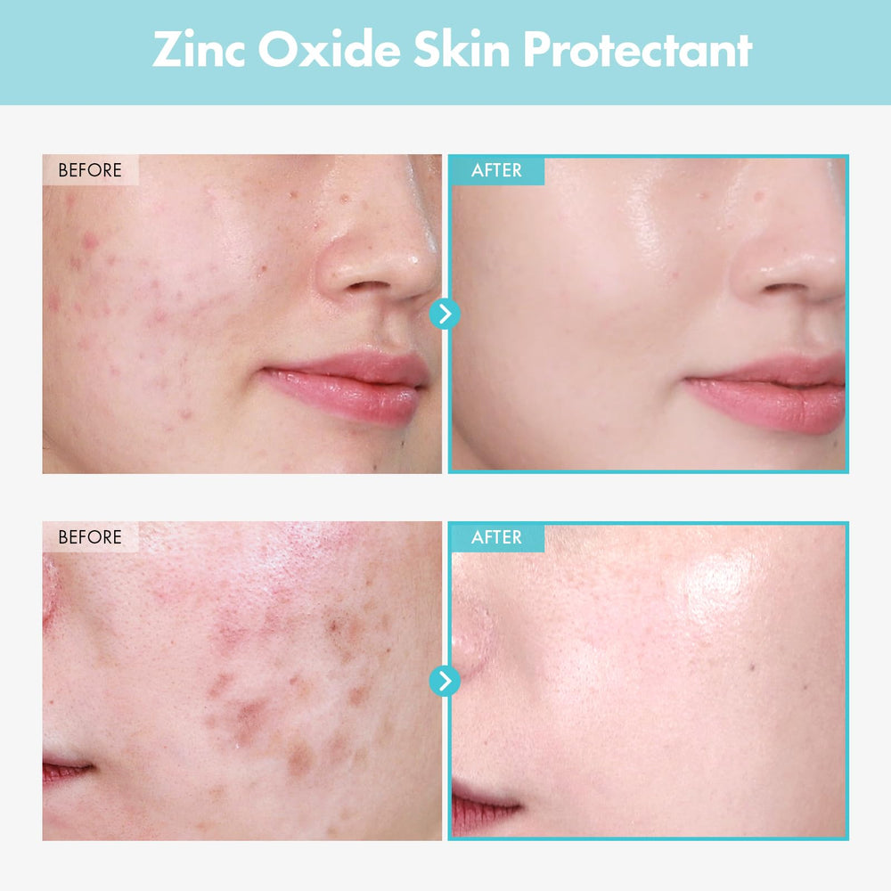 TOSOWOONG zinc oxide powder close-up emphasizing skin protection.