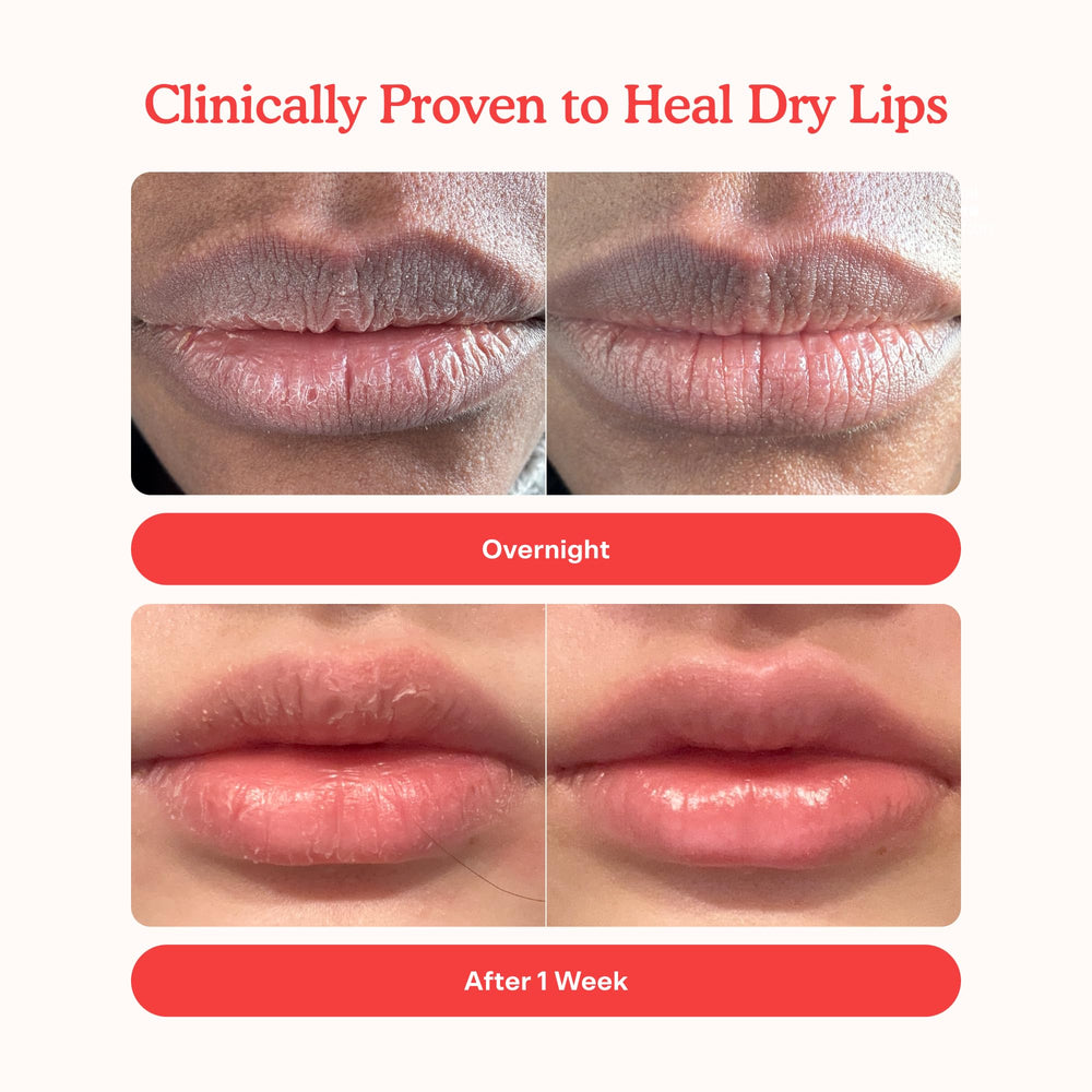 LipSoftie con aceite de jojoba, ayuda a prevenir la sequedad de labios.