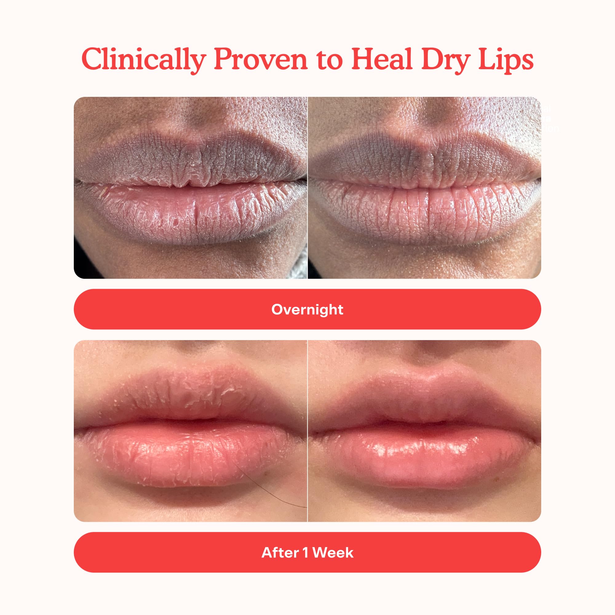 Bálsamo labial tintado LipSoftie en envase compacto para retoques
