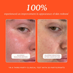 Tower 28 SOS Daily Rescue skin toner application demonstrates gentle cleansing.