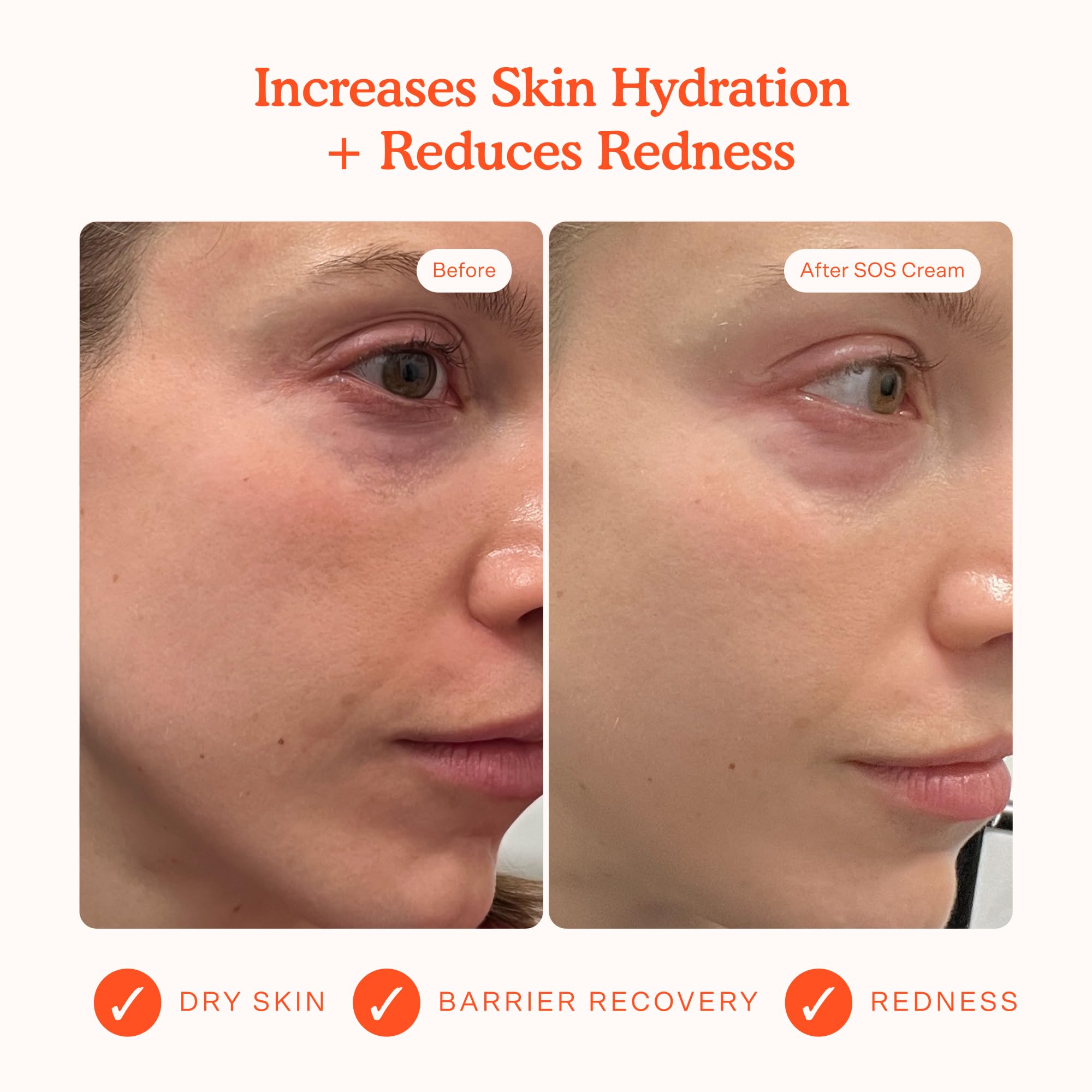 Texture close-up of Tower 28 SOS Recovery Face Cream showing creamy hydration