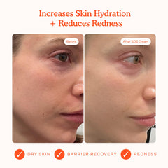 Texture close-up of Tower 28 SOS Recovery Face Cream showing creamy hydration