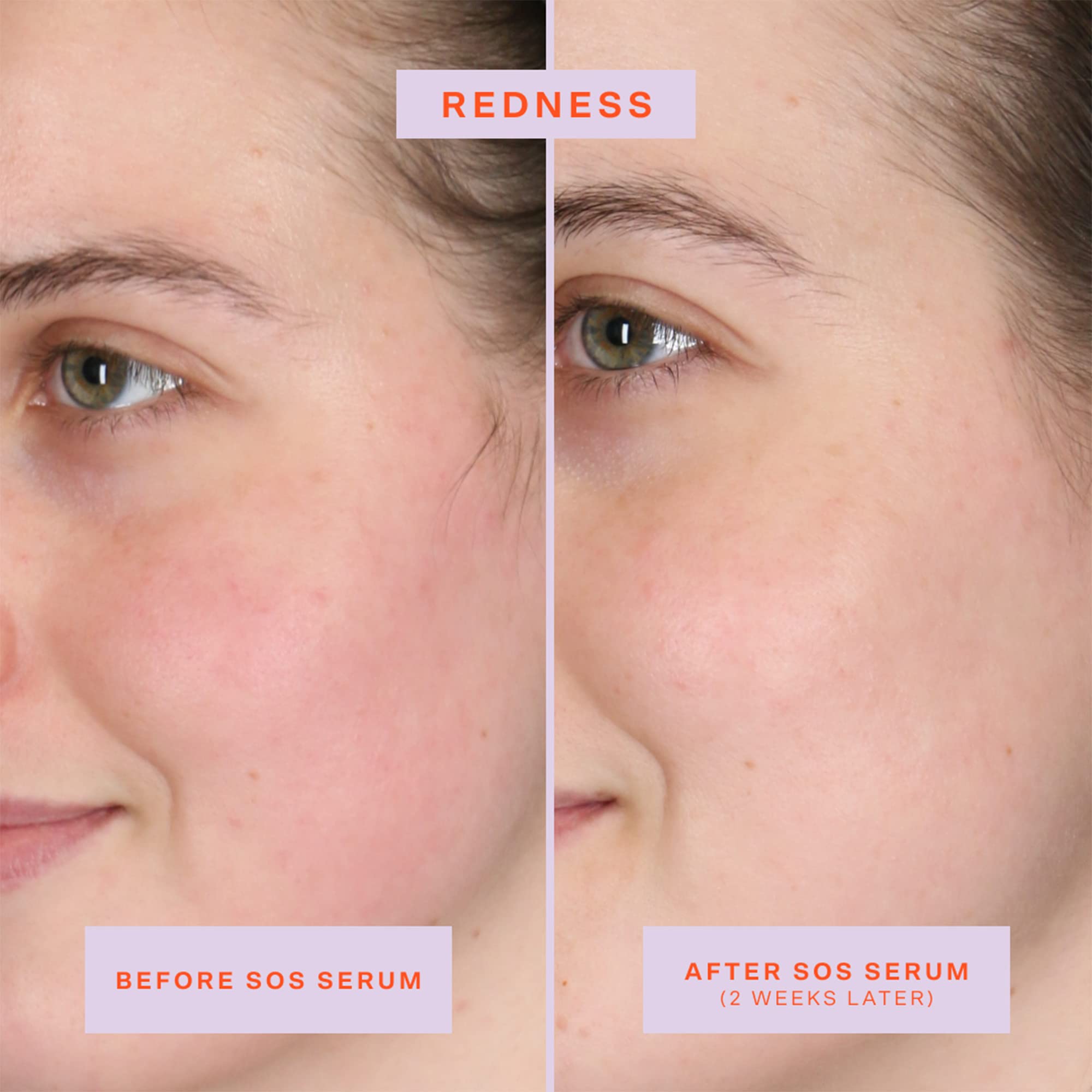Tower 28 SOS Rescue application during routine uses 2-3 pumps for calm skin