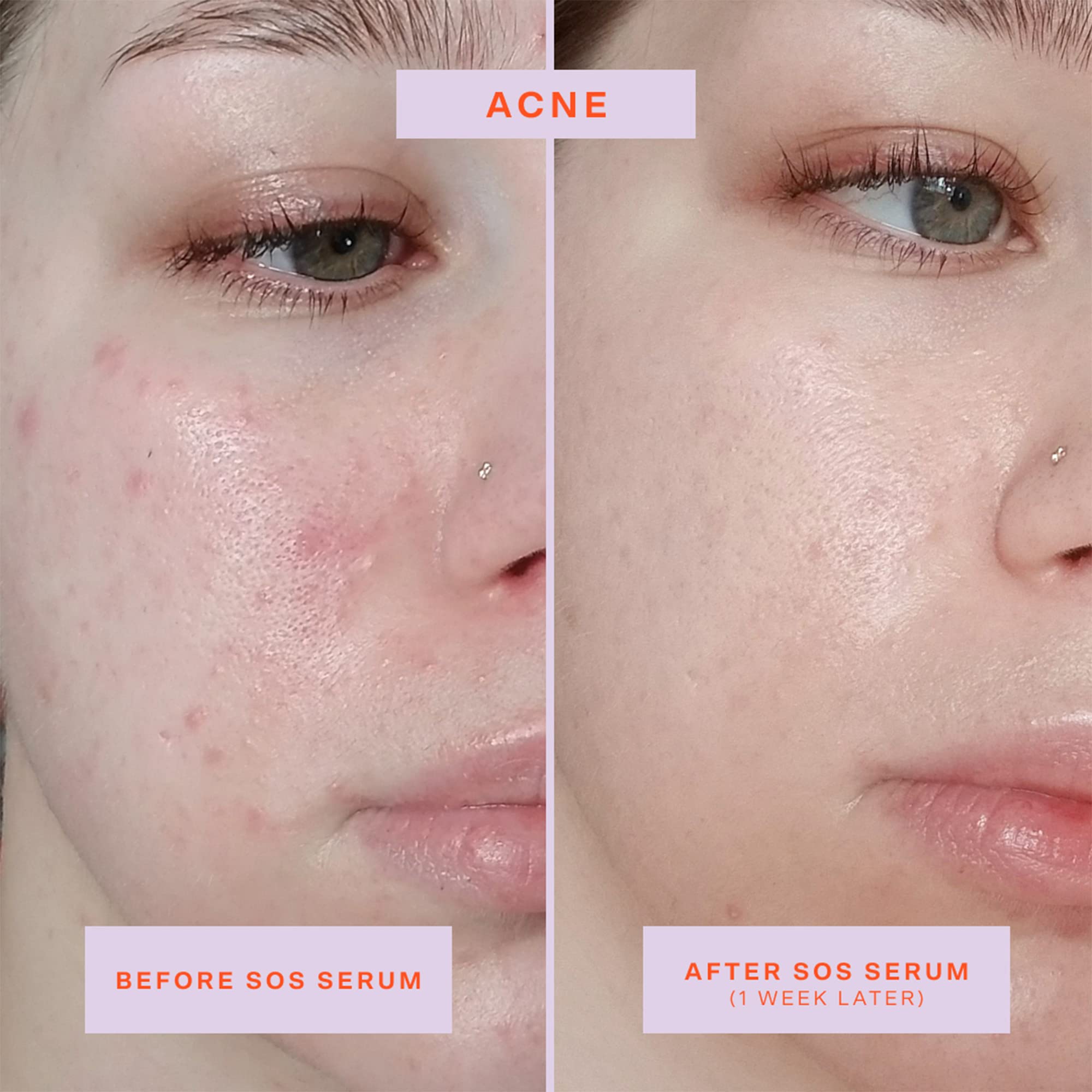 Tower 28 SOS Rescue serum closeup shows lightweight texture for sensitive skin
