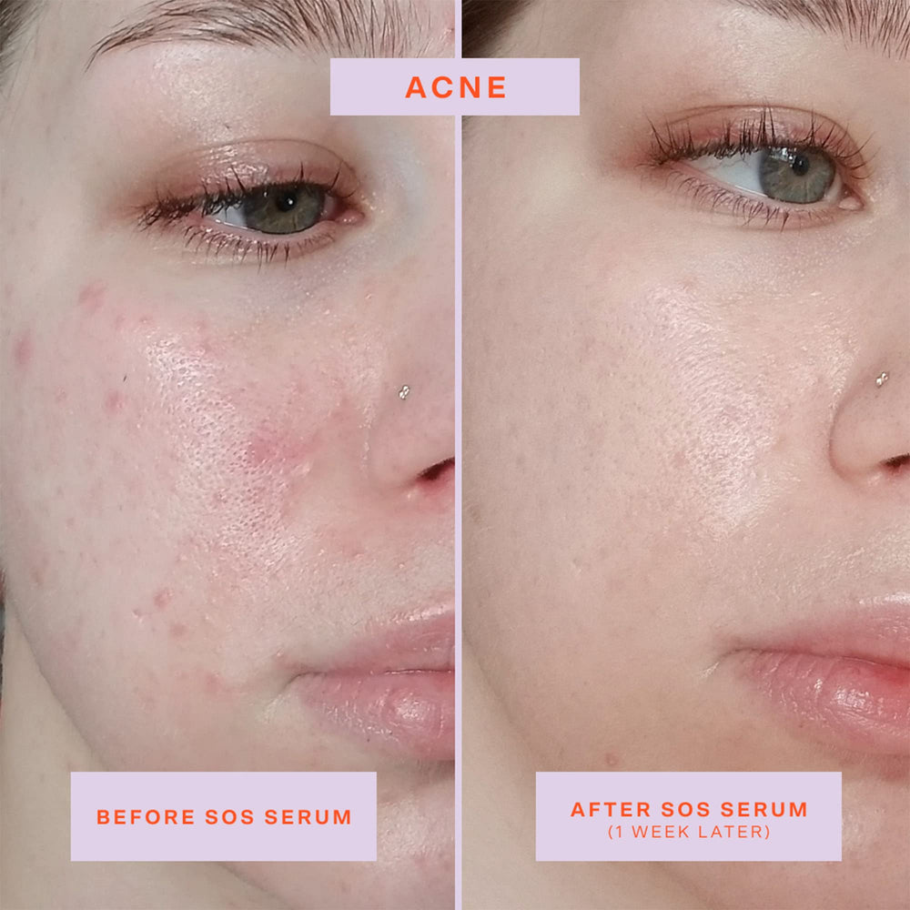 Tower 28 SOS Rescue serum closeup shows lightweight texture for sensitive skin
