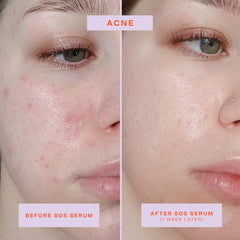 Tower 28 SOS Rescue serum closeup shows lightweight texture for sensitive skin