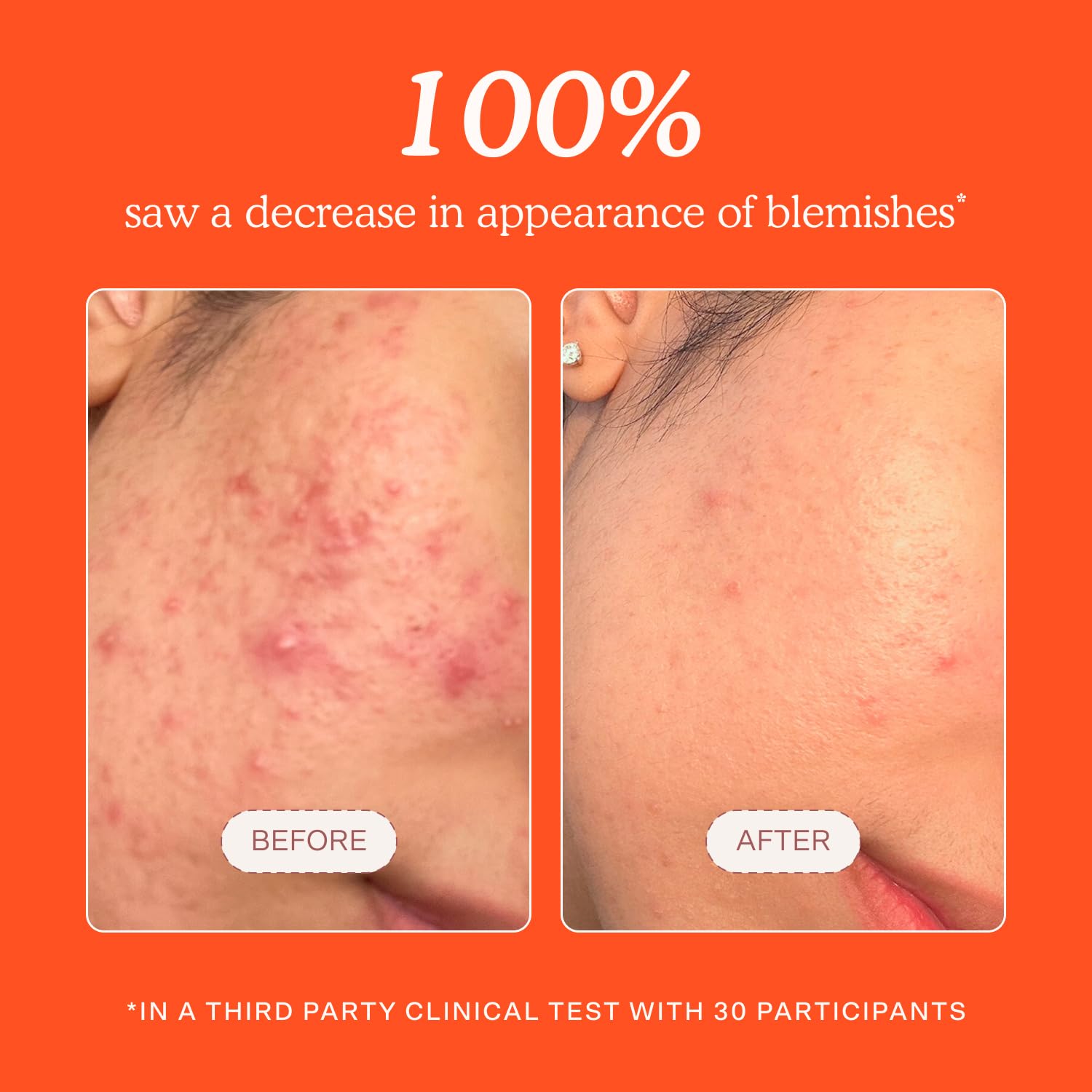 Tower 28 SOS spray applied on cheek demonstrating soothing care