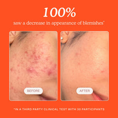 Tower 28 SOS spray applied on cheek demonstrating soothing care