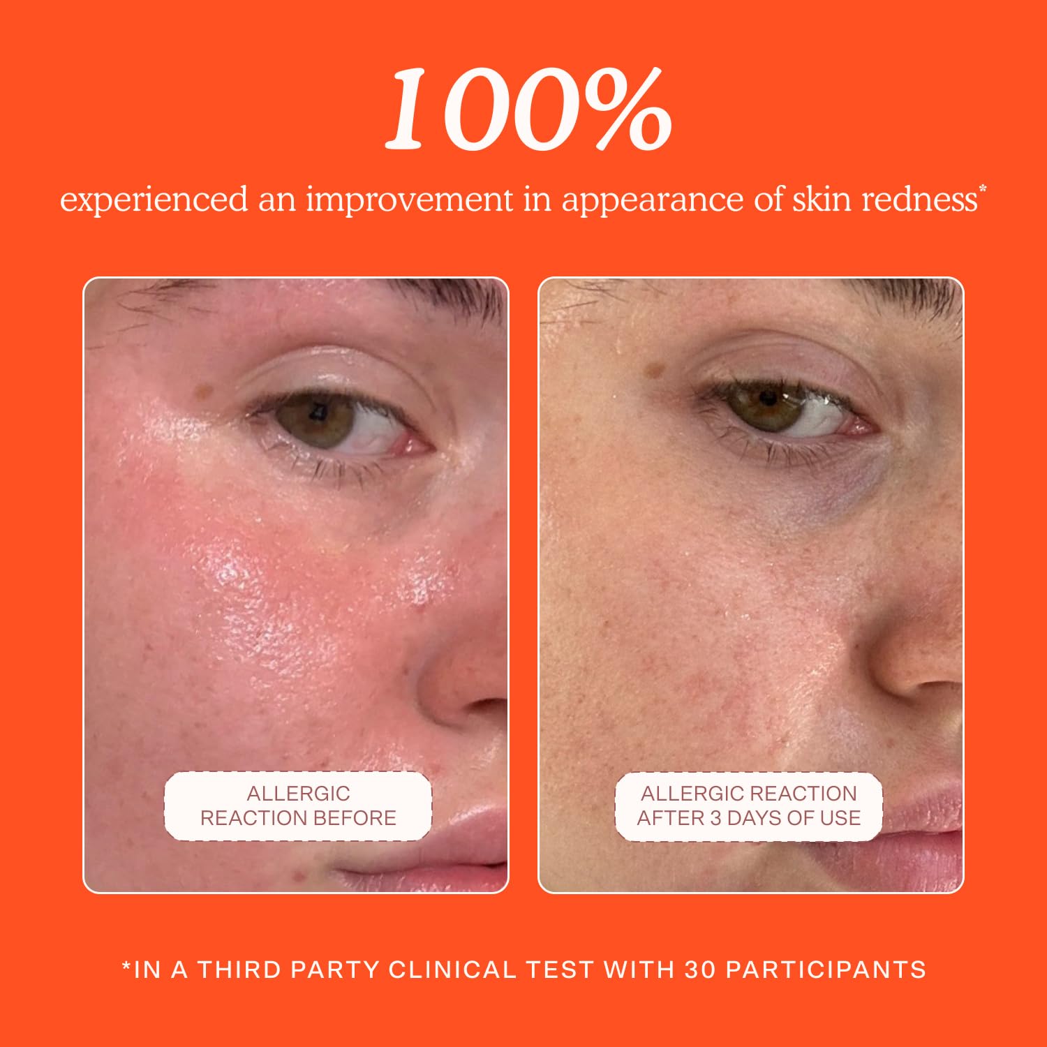 Tower 28 SOS bottle closeup highlighting hypochlorous acid formula for sensitive skin