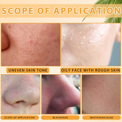 Limpiador facial TPTAL con cepillo: primer plano del cepillo suave.