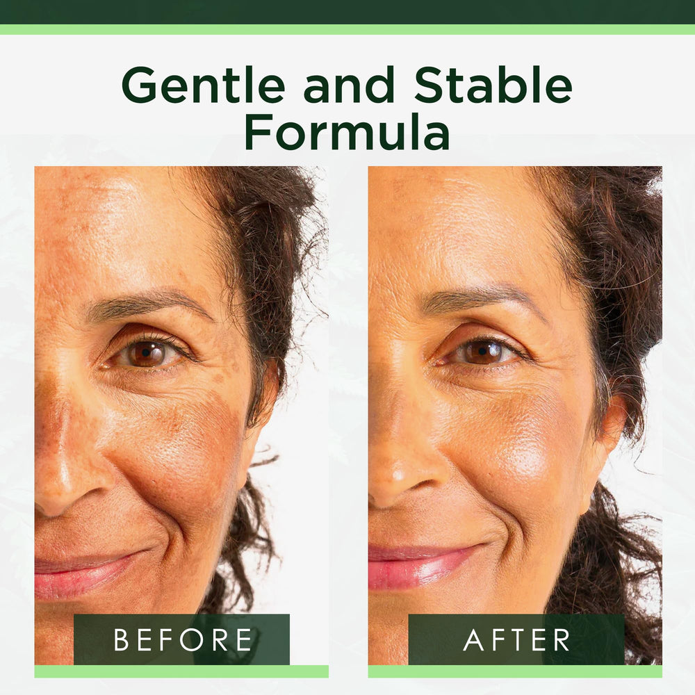 Aplicación en piel con Tree of Life Beauty Niacinamida Serum, cuidado suave.