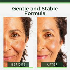 Aplicación en piel con Tree of Life Beauty Niacinamida Serum, cuidado suave.