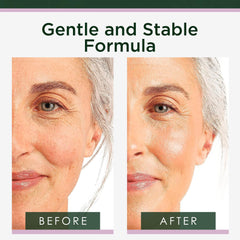 Tree of Life Beauty Retinol Serum: hidratación profunda gracias al ácido hialurónico.