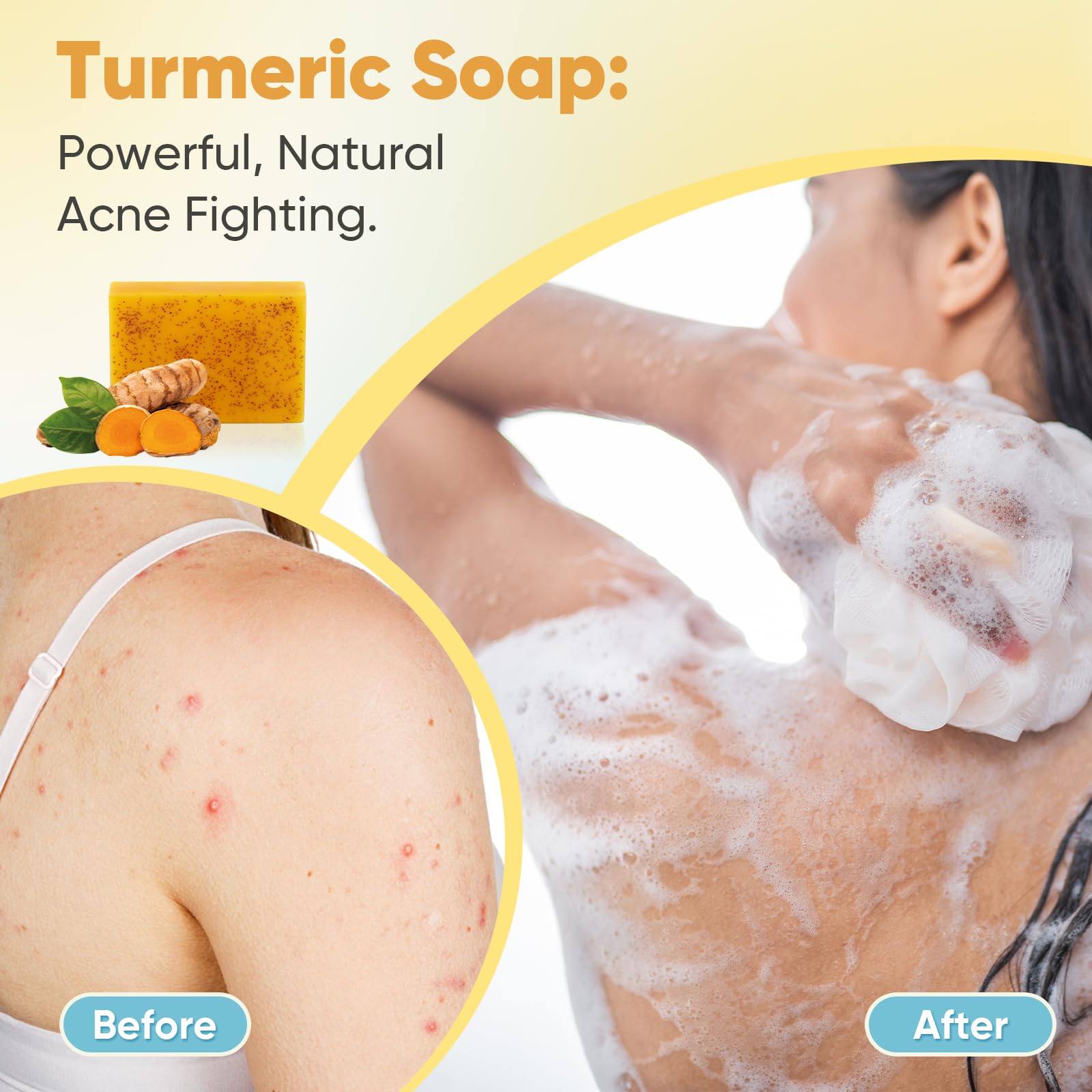 Treeroot turmeric soap being applied on skin suggesting moisturized, refreshed feel