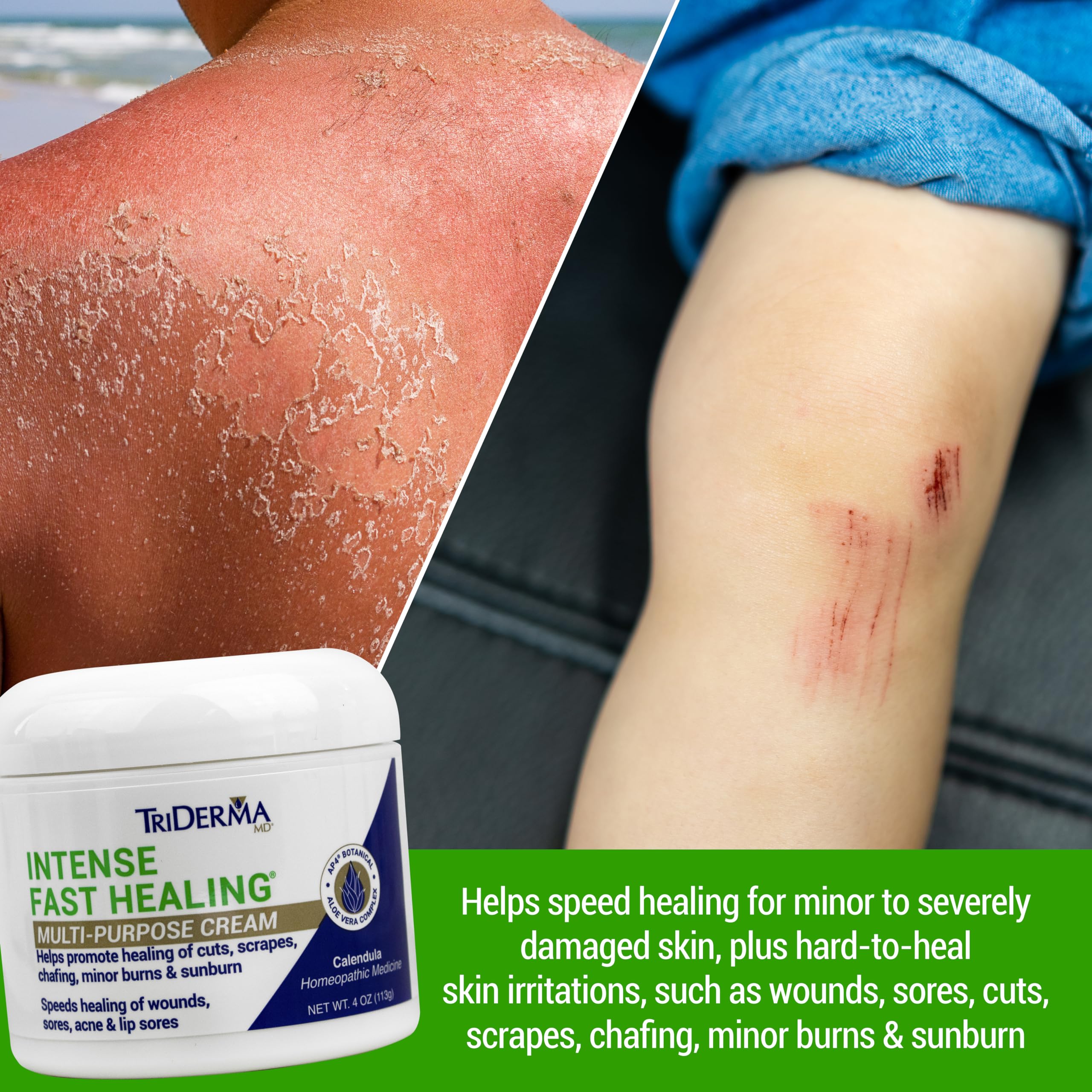 TriDerma Crema Curación Intensa en tarro para aplicación precisa.