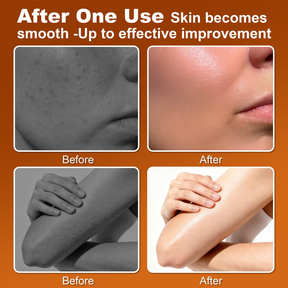 Trihood Peel Shot: extracto turmerico y ácido kojico para tono más uniforme.