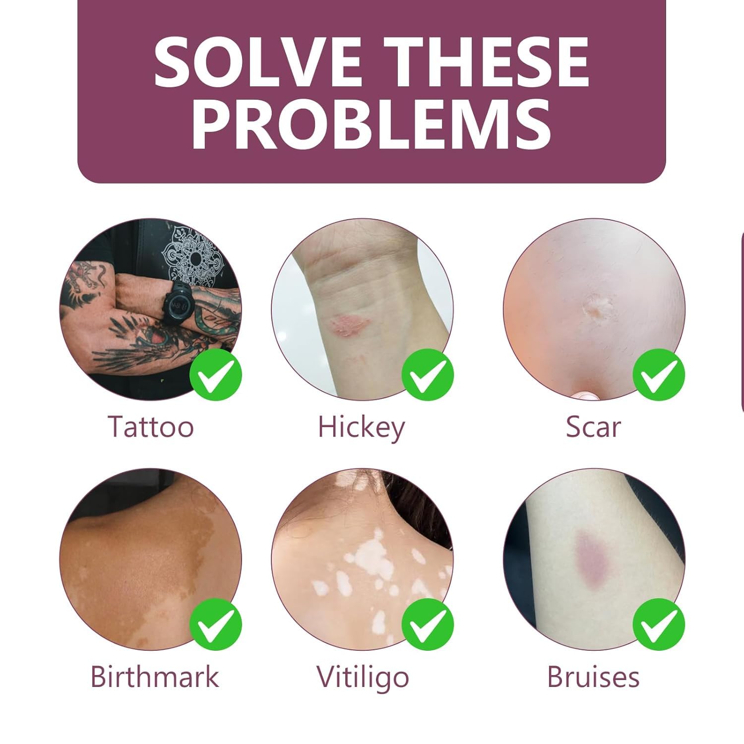 TRIXES tatuaje imperceptible con corrector, ideal para uso diario.