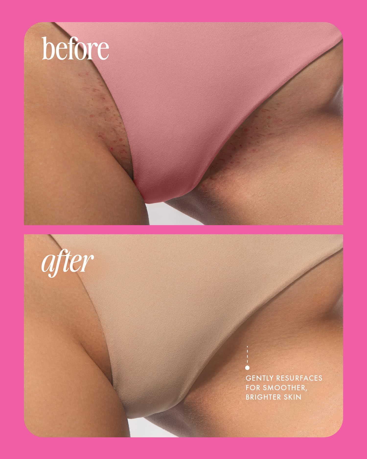 Truly Beauty Ergonomic design enhances grip for comfortable daily shaving