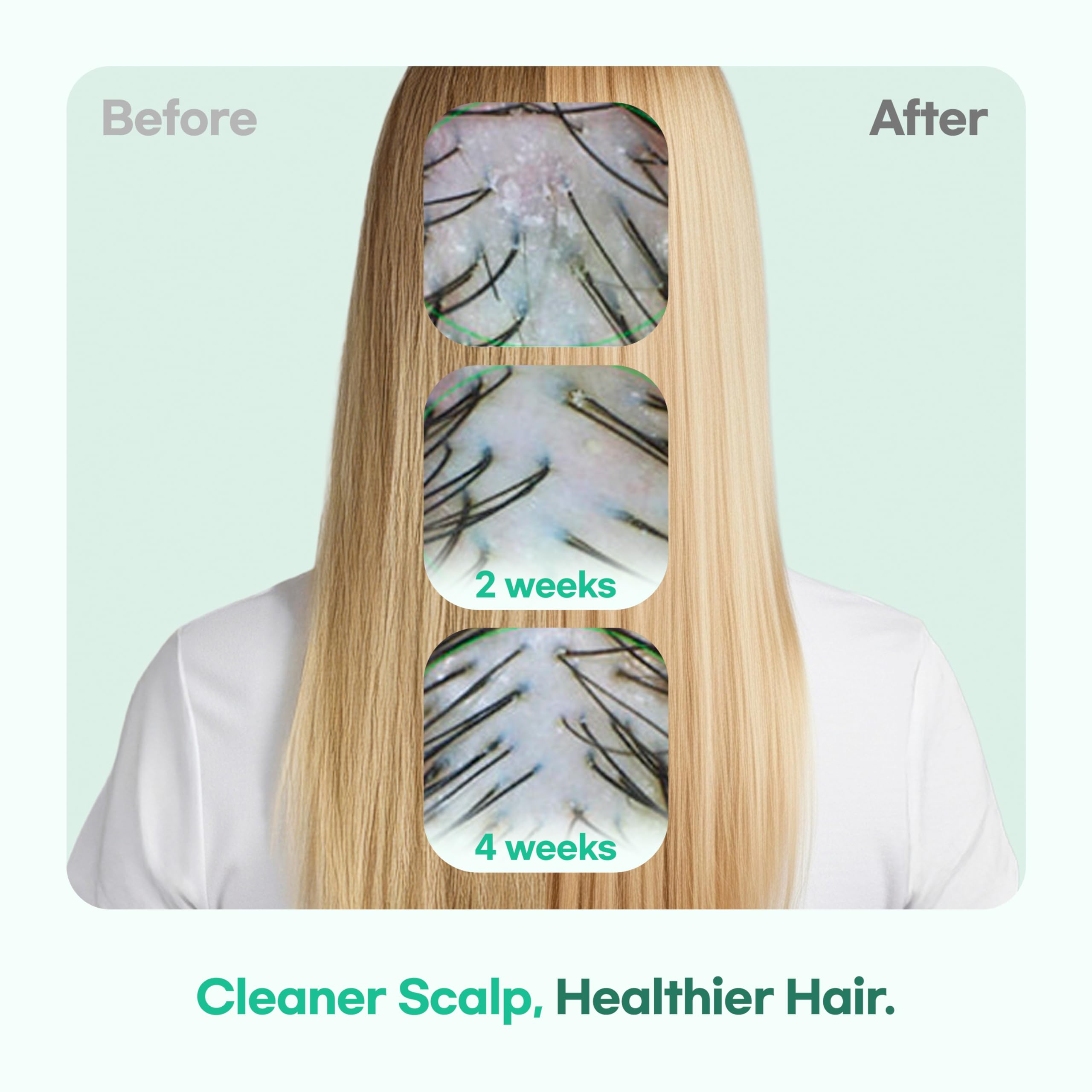 TS GD Shampoo etiqueta cercana, visión clara de su fórmula anti irritación.