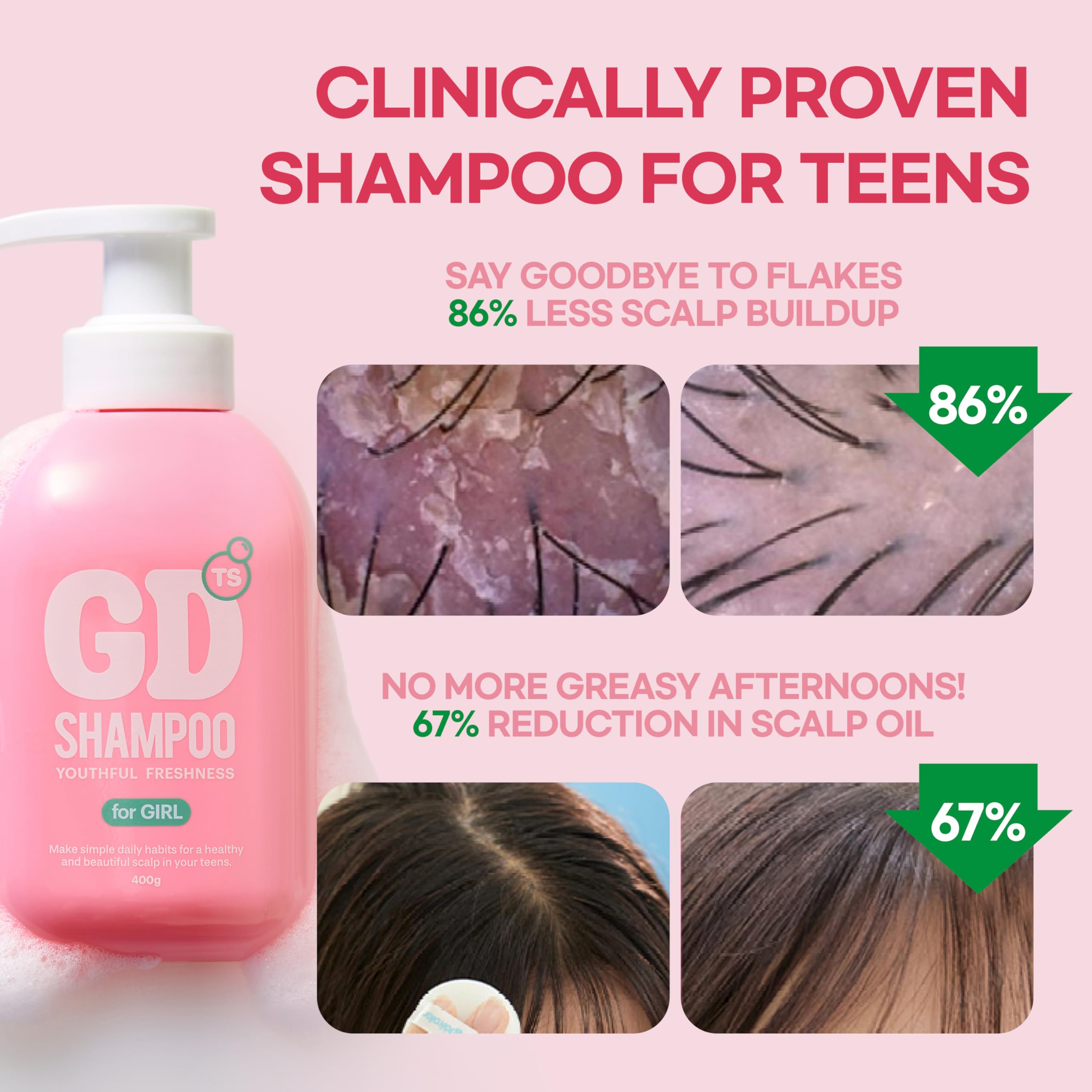 TS GD Shampoo para adolescentes, ingredientes sin sulfatos; apto para piel sensible.