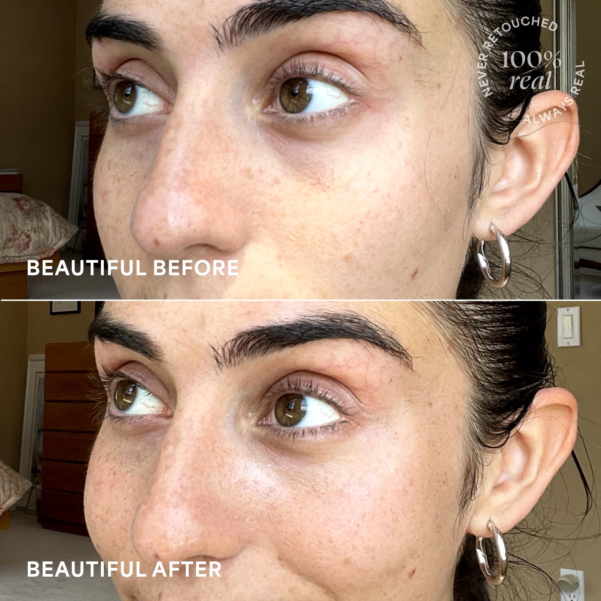 Undereye area glows softly after TULA application.