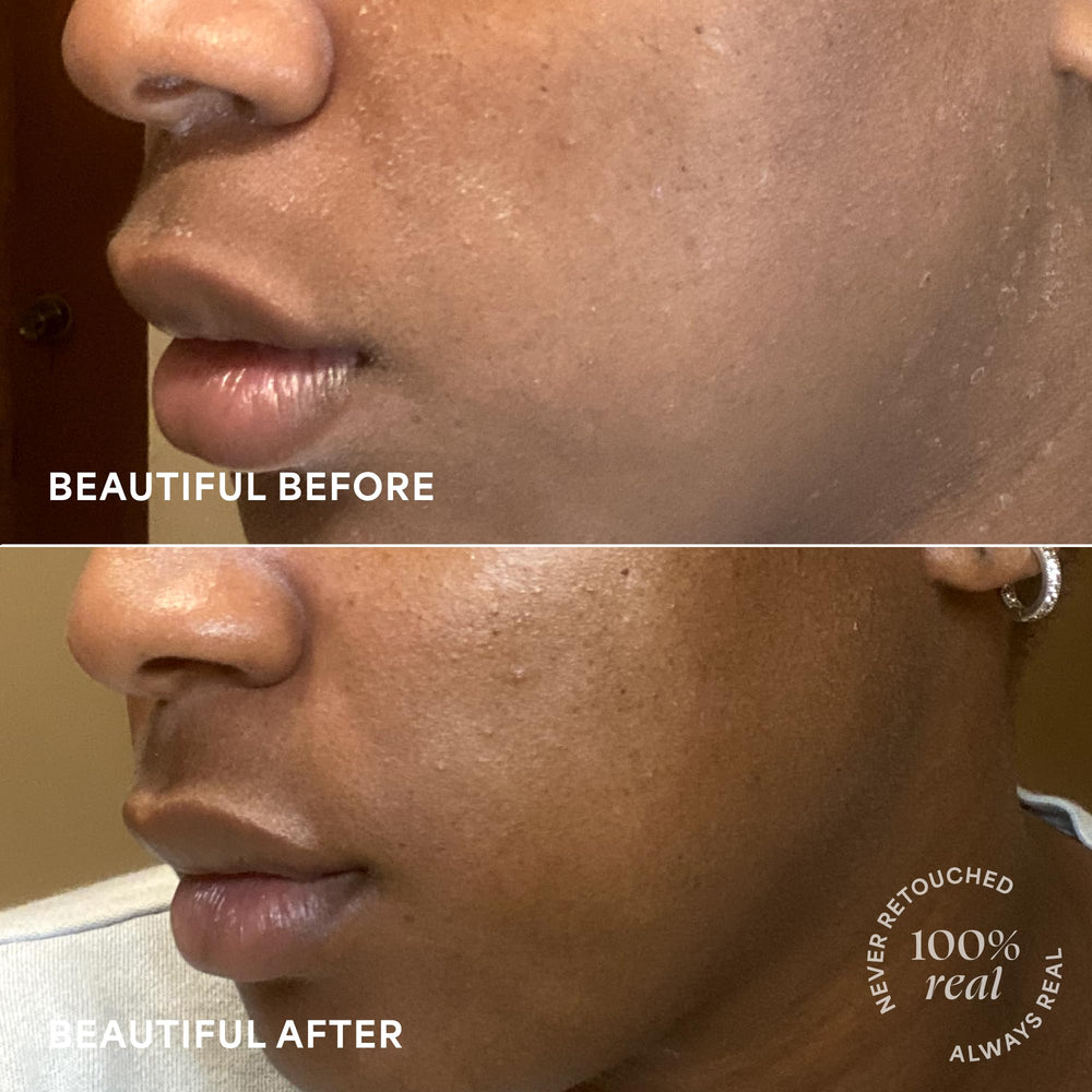 TULA probiotic extracts visual emphasizes clean skincare with actives
