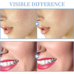 TUMAKOU tongue tube designed for delicate zones.