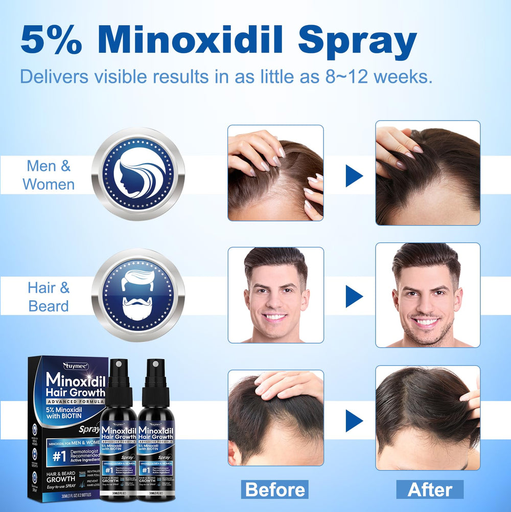 Tuymec Minoxidil 5% para mujeres con cabello fino