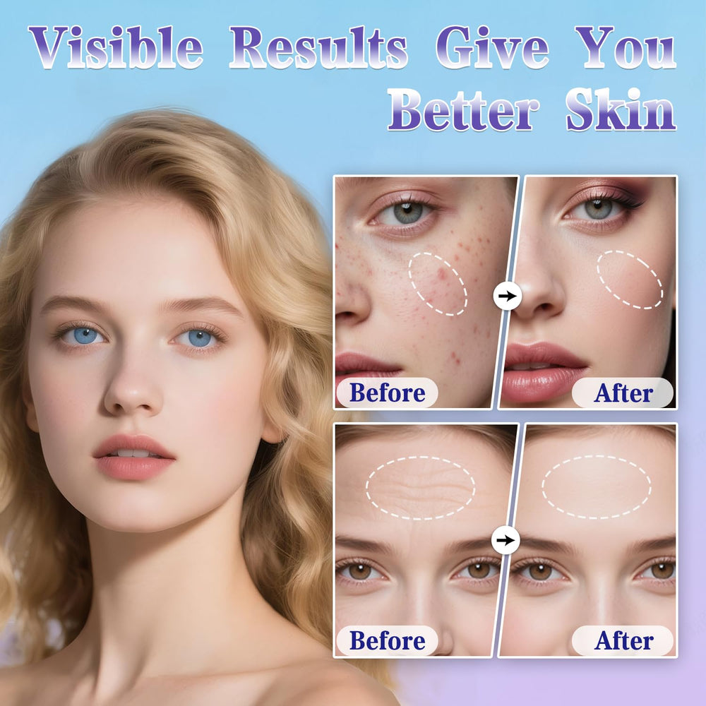 Uaike Derma Stamp scalp tool offering targeted micro-application at home.