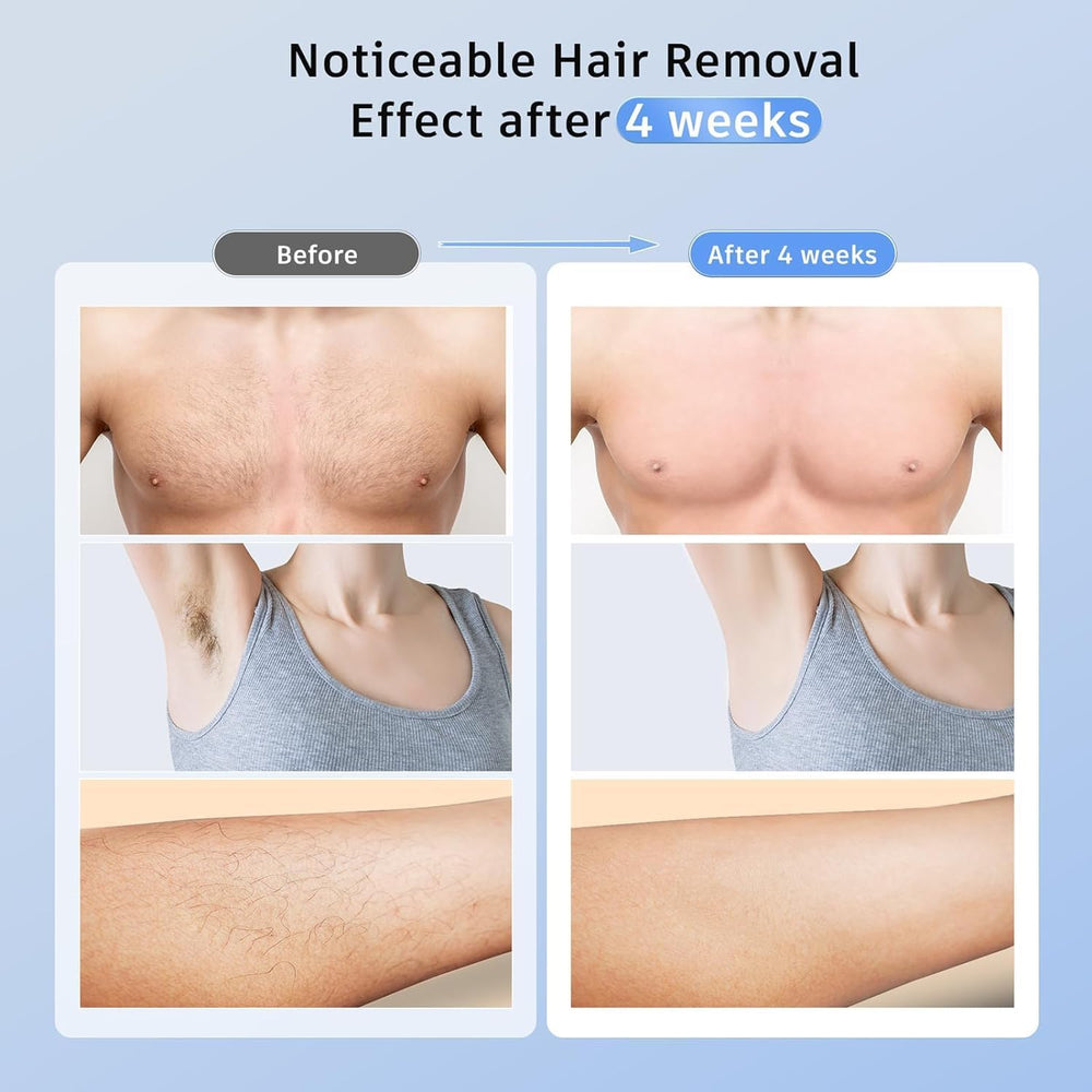 Full-body use for legs, bikini, and underarms with Ubroo IPL.
