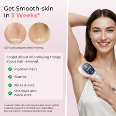 Ubroo IPL hair removal for legs offers broad-area coverage and efficiency.