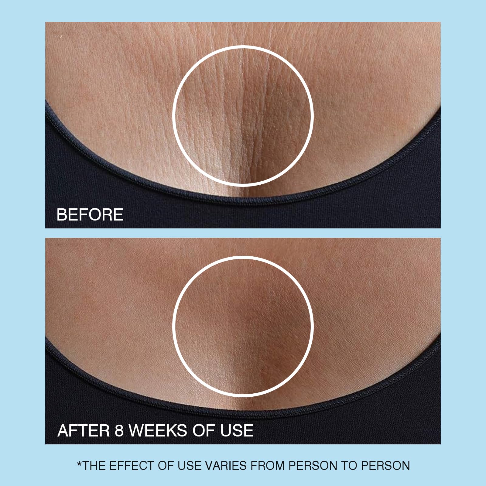 UJHAY Retinol Cuello Crema Embalaje Exterior: packaging seguro y atractivo en estantería