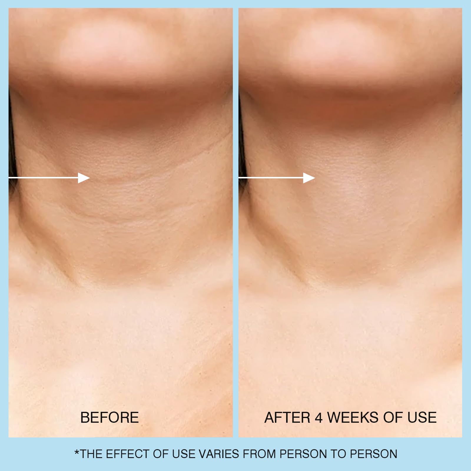 UJHAY Retinol Cuello Crema Envase 50ml: práctica dosis para uso diario