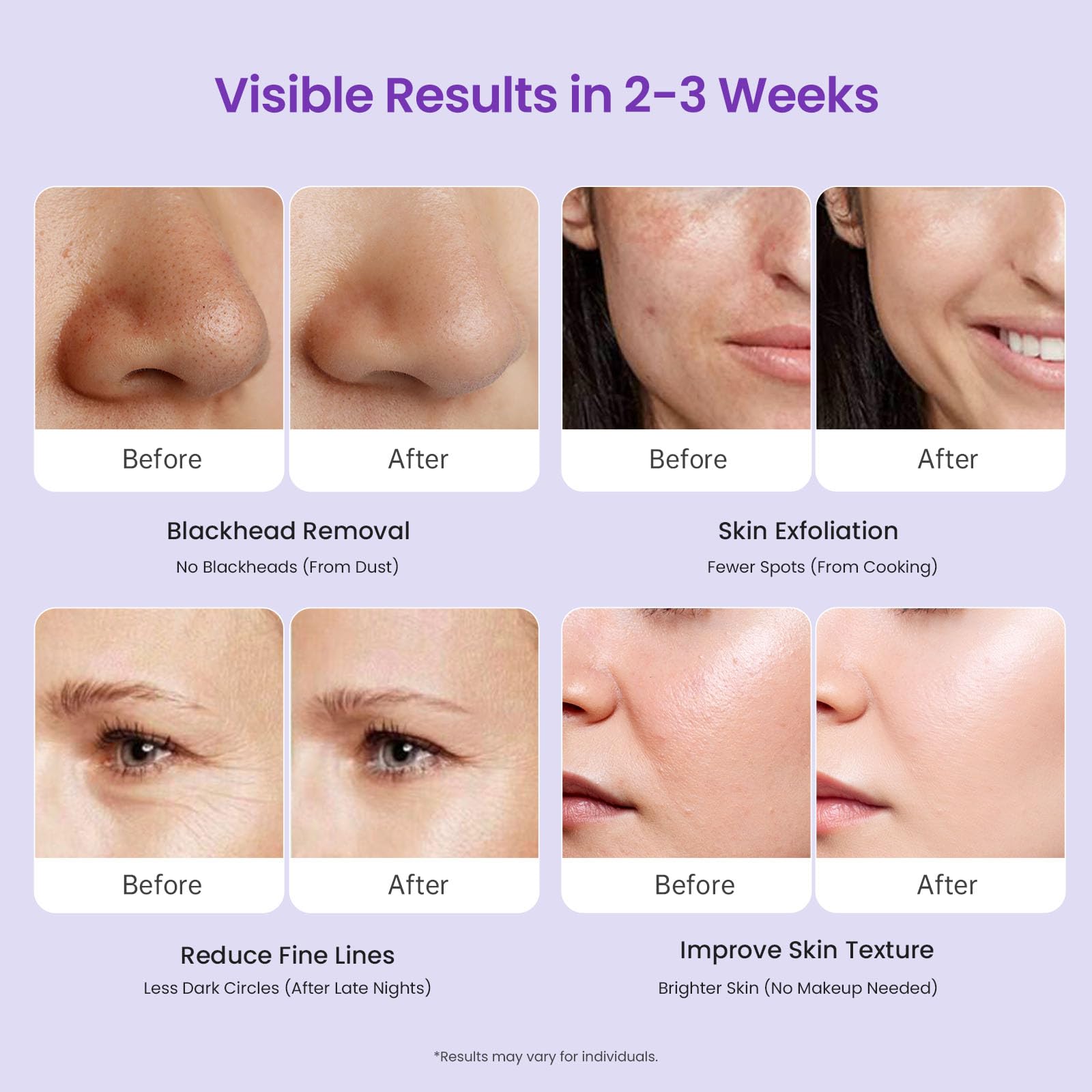 UNOISETION at-home skincare scene showing easy setup and usage