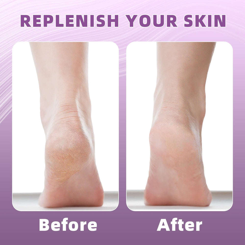 Untrytb calcetines silicona con crema, mejor absorción de humectante