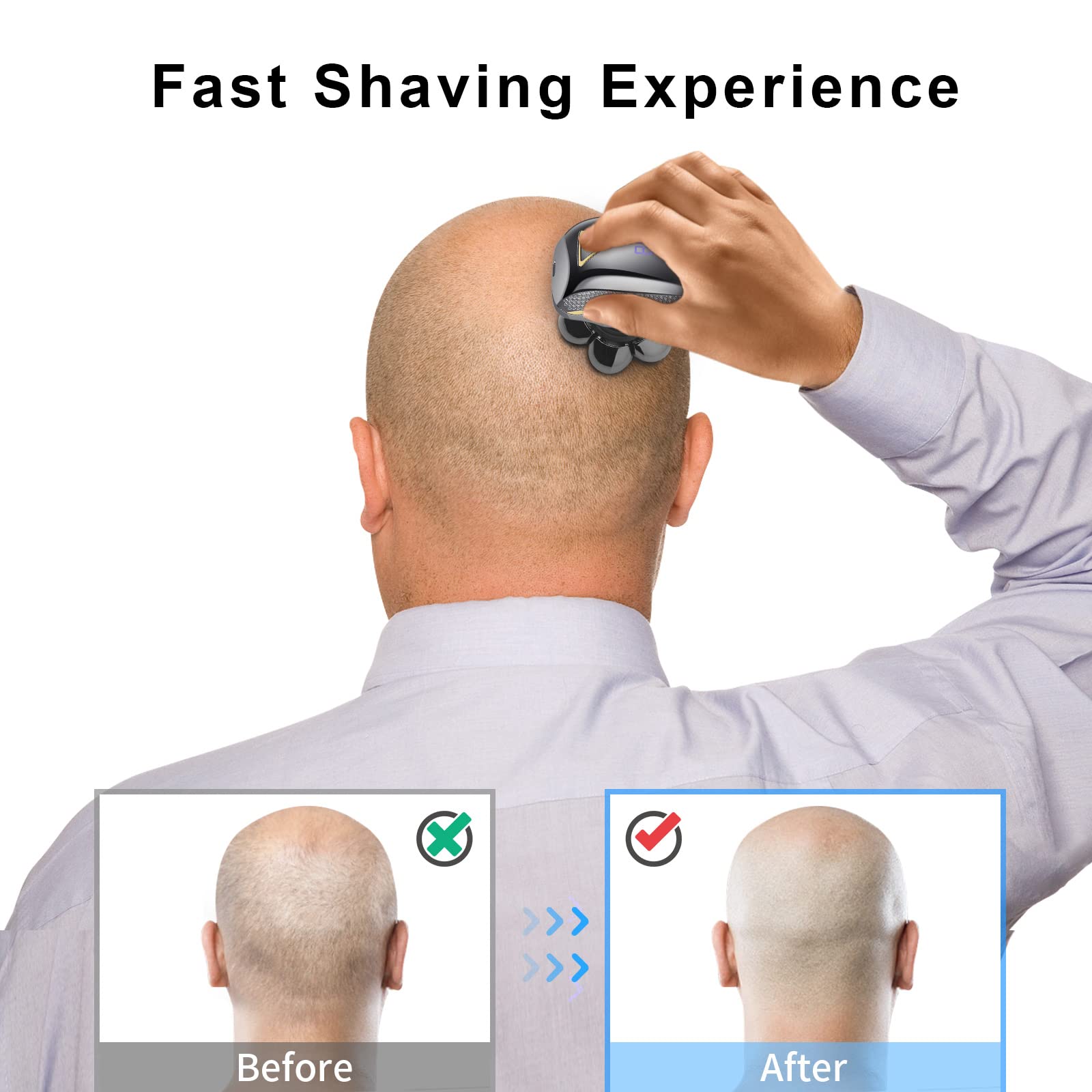 UPTARD stainless steel rotary blades provide durable, smooth shaving.