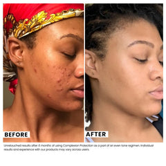 Urban Skin Rx aplicación diaria: hidratación y protección en una crema suave