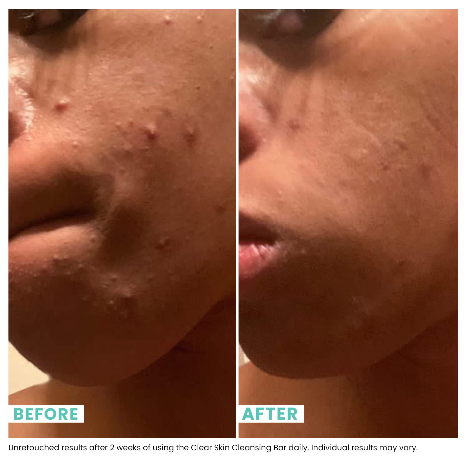 Salicylic sulfur blend from Urban Skin Rx targets blemishes and excess oil gently.