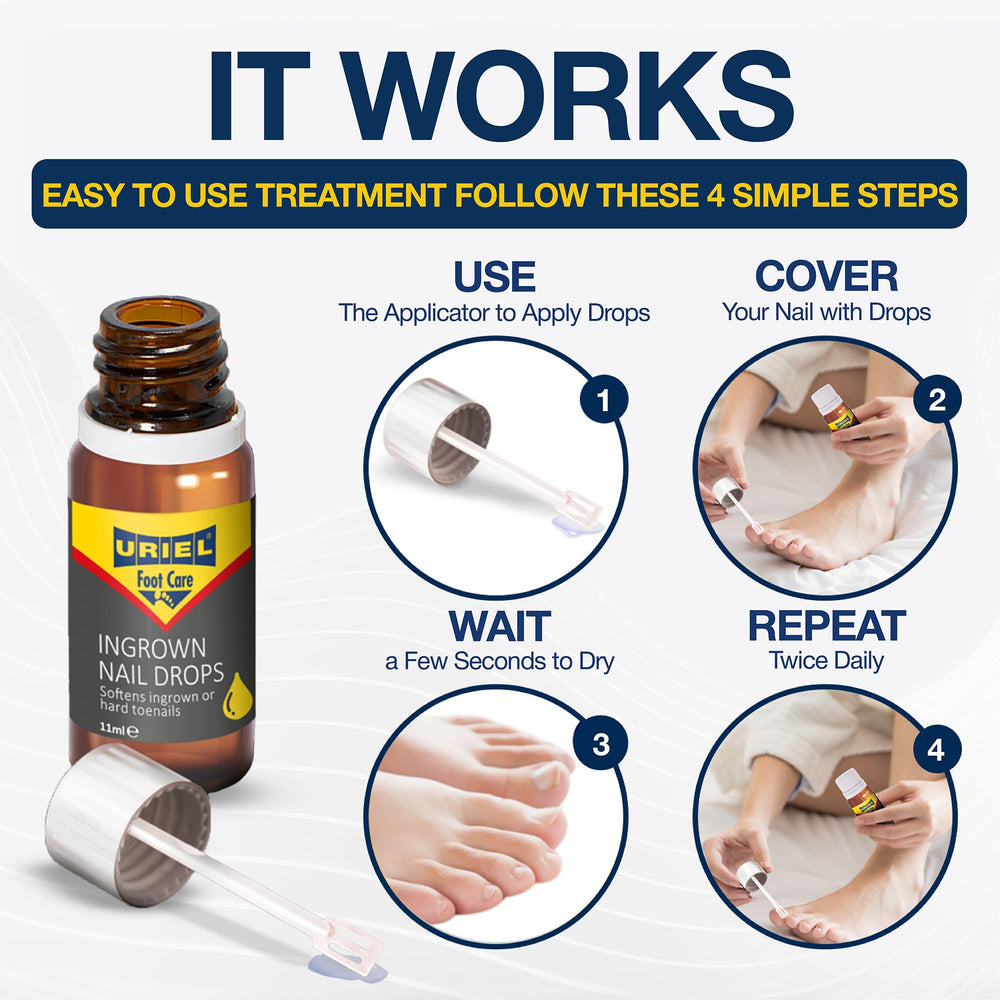 URIEL home treatment setup for toenails illustrates easy at-home care routine.
