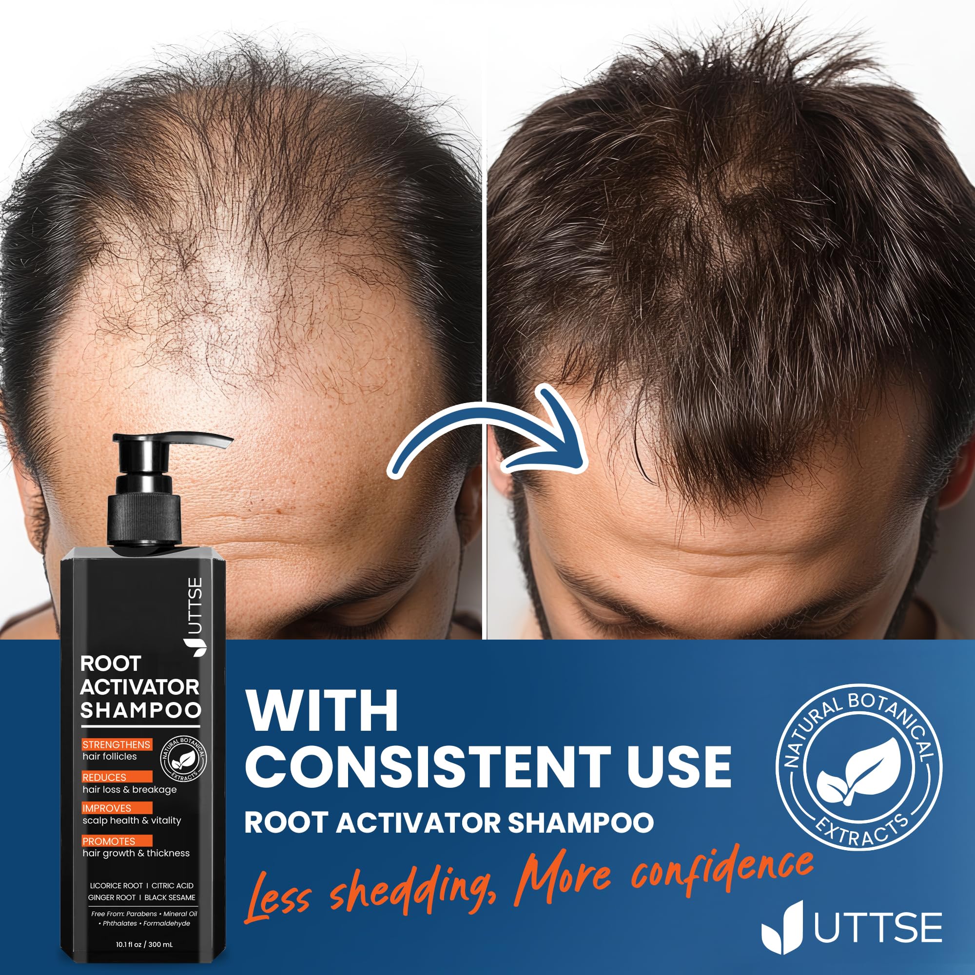 Uttse Root Activator Shampoo for Men scalp application demonstrates massage friendly texture.