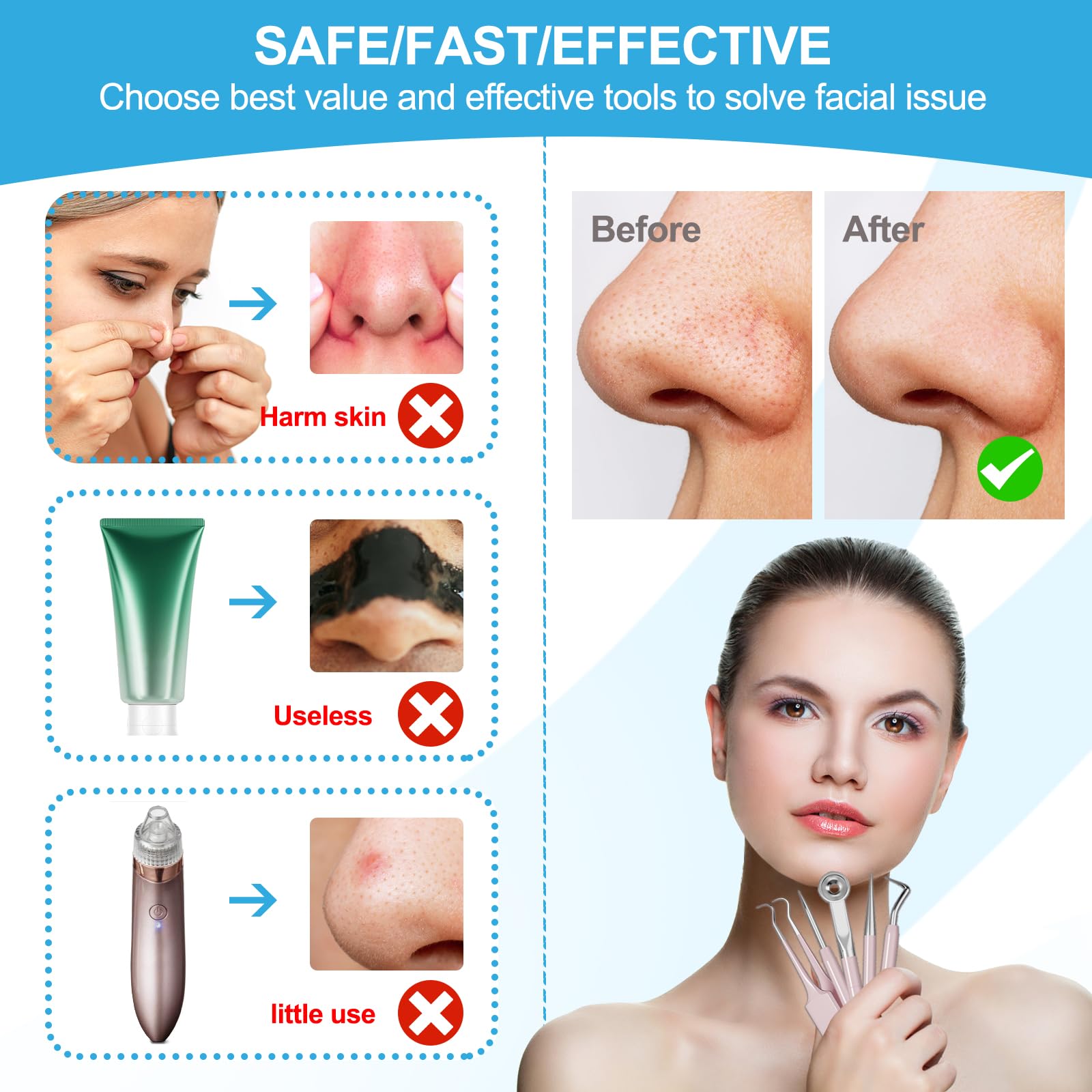 UWOIST blackhead remover tweezers for precise nose extractions