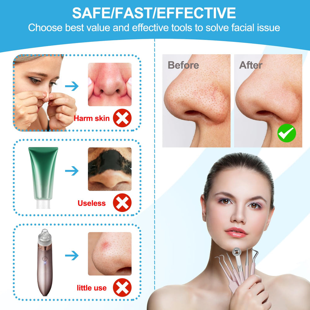 UWOIST blackhead remover tweezers for precise nose extractions