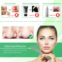 UWOIST dual-head extractor for versatile blemish removal on nose and chin.