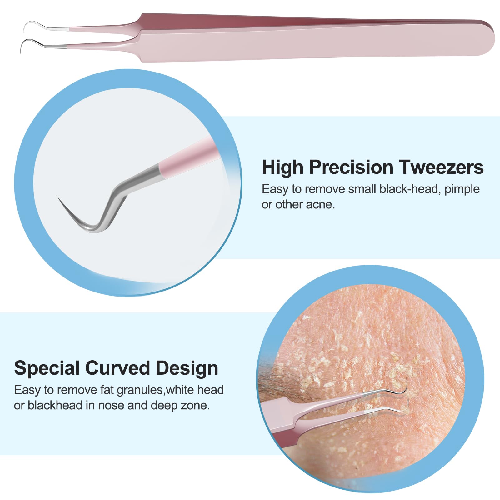 UWOIST loops in five sizes clear various blackheads