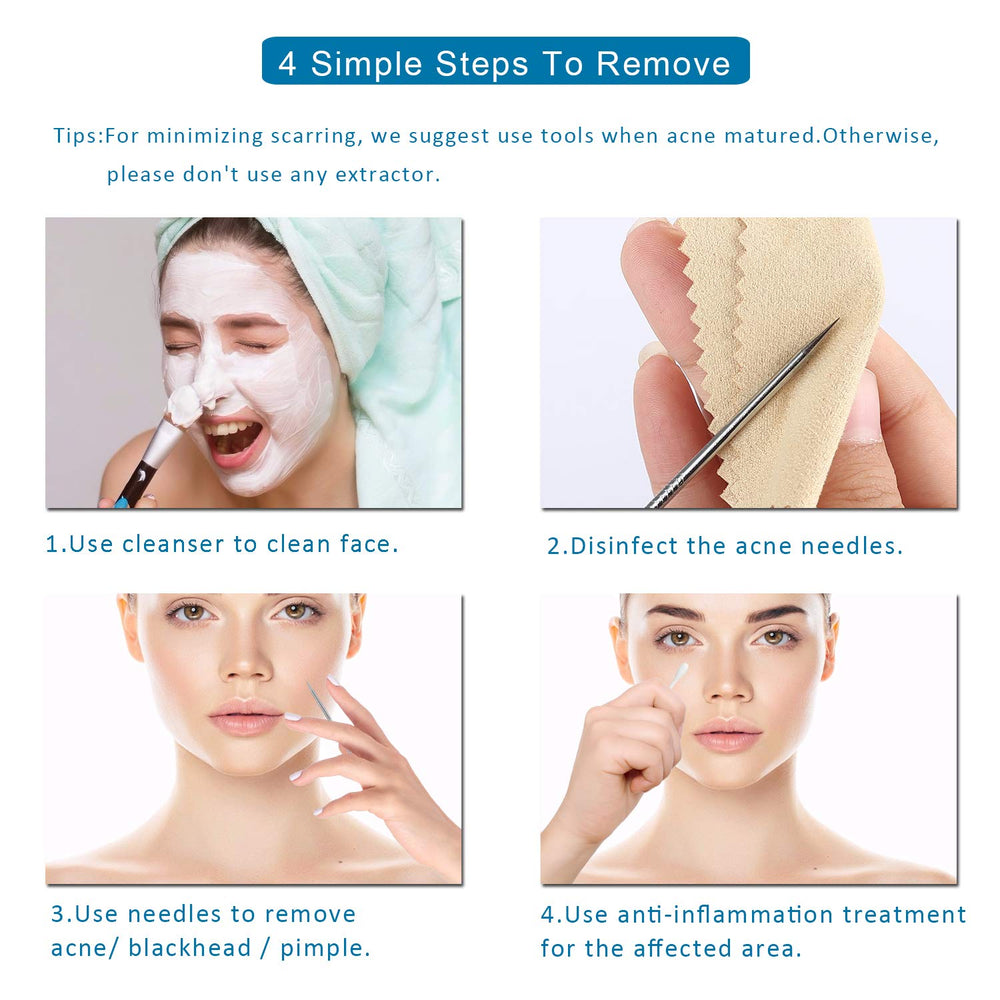 UWOIST professional-at-home tools for controlled blemish extraction.
