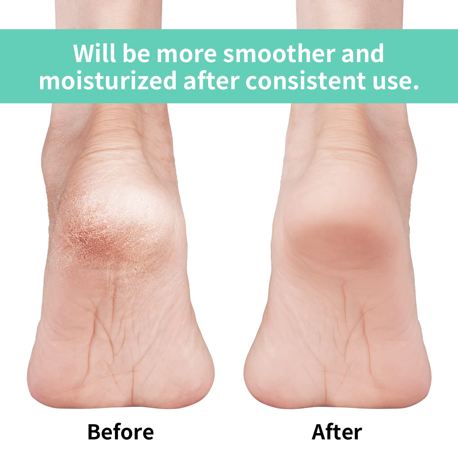 Vaincre gel heel socks with vitamin E and mineral oils for moisturized feet