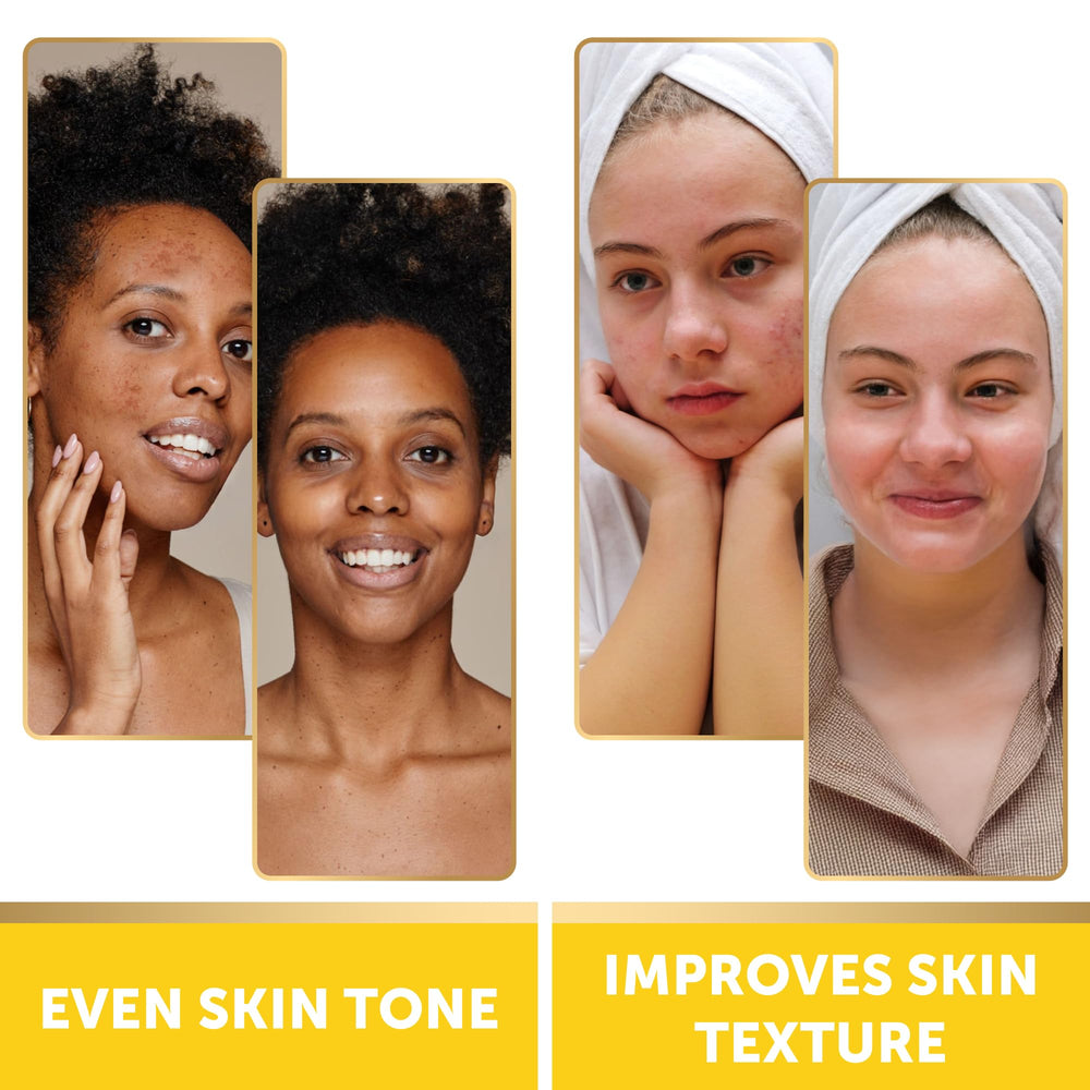 Valitic disco exfoliante con vitamina C para atenuar manchas y tono uniforme.