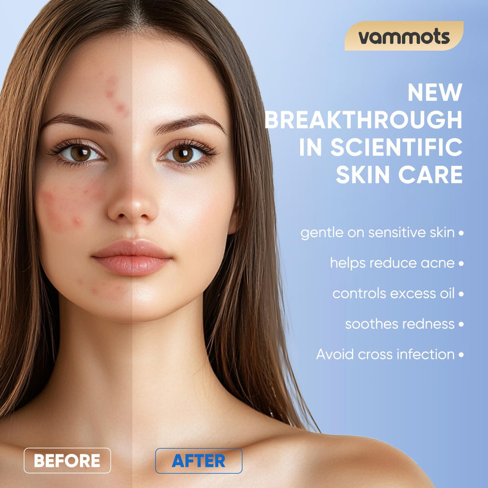 Vammots makeup-removal towels lift makeup and sunscreen safely.