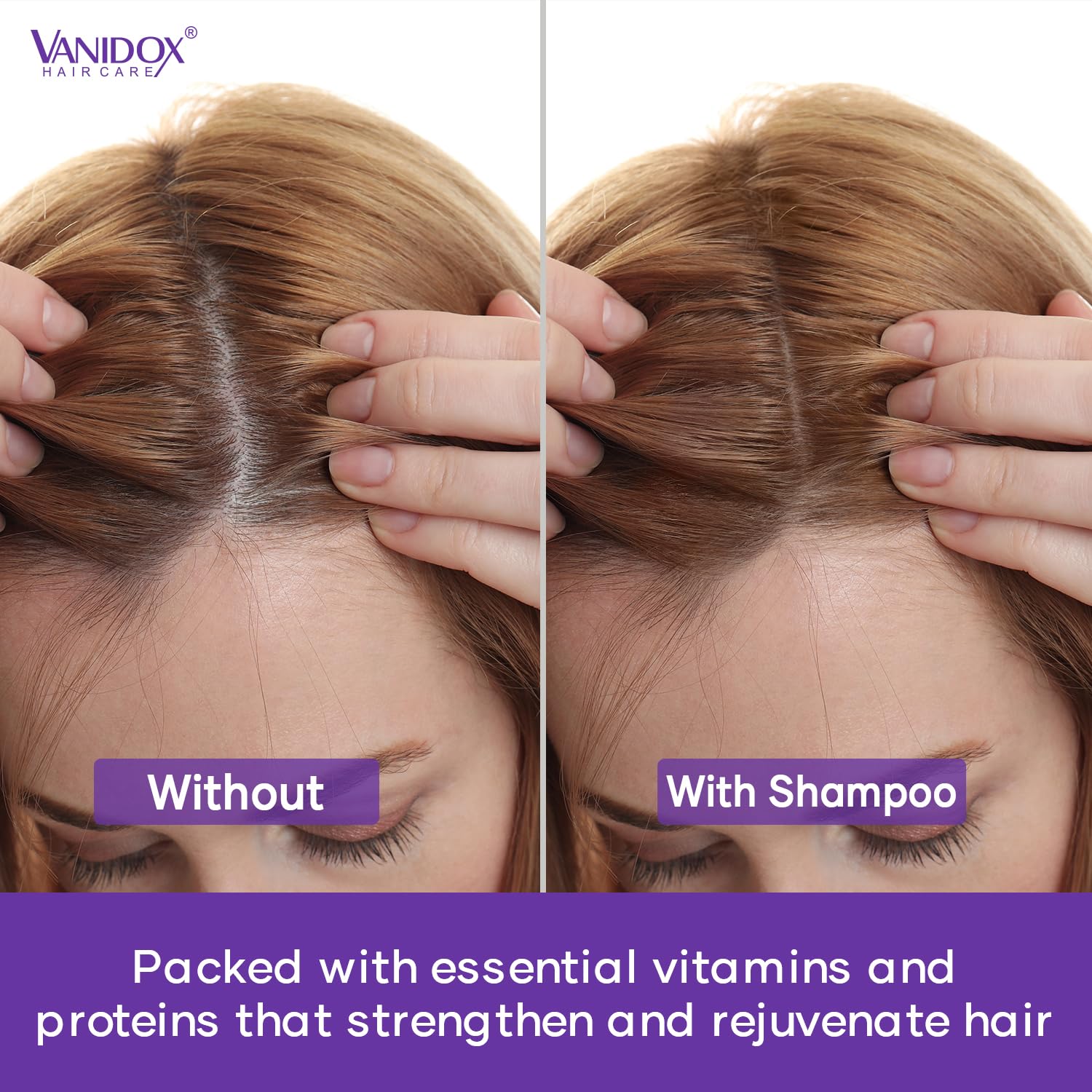 Vanidox Scalp refresh application closeup for soothing scalp